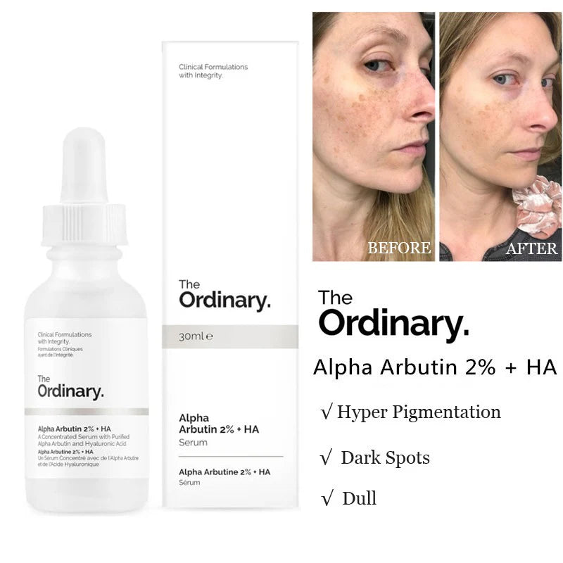 The Ordinary Alpha Arbutin 2% + HA, Serum Base. 30 ml- For Skin Brightening