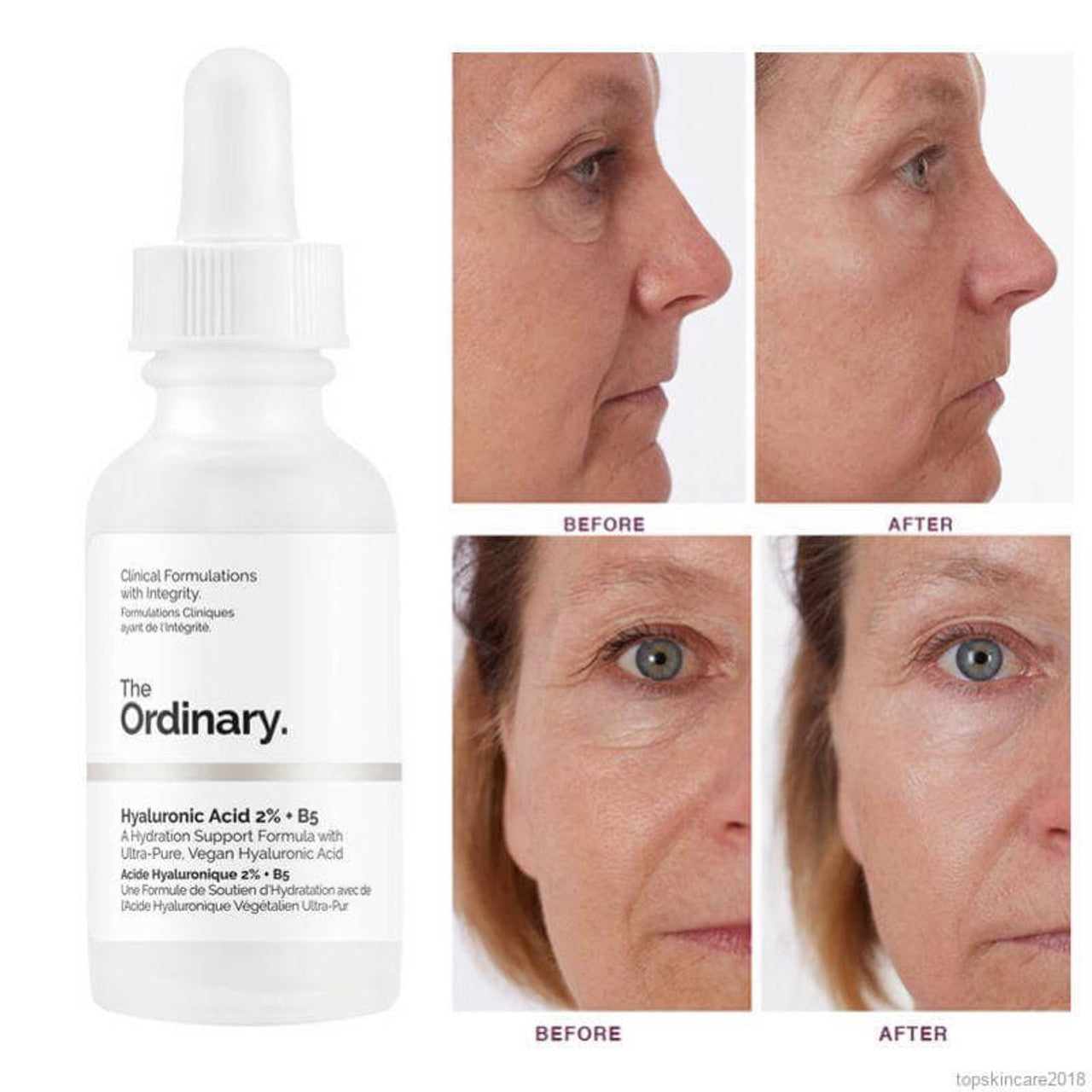 The Ordinary Hyaluronic acid 2% + B5 sérum base 30 ml For skin Tightening
