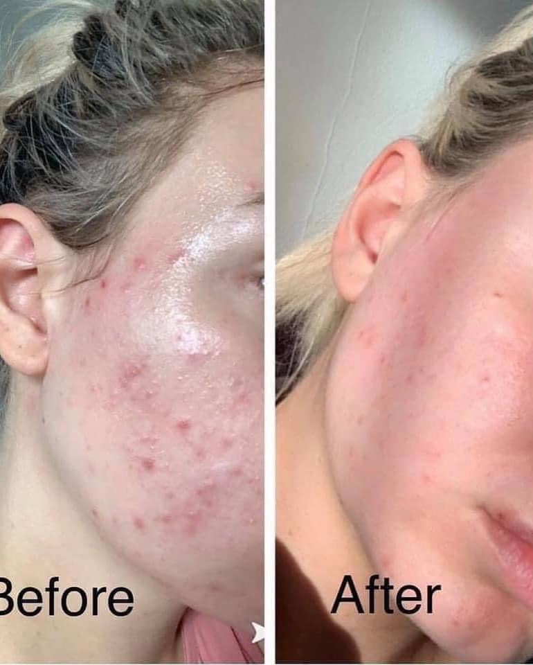 CeraVe -Renewing SA Cleanser Best Face wash